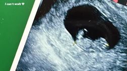 Il derby vinto e l’ecografia del secondogenito: che momento per Zaccagni e Chiara Nasti!