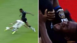 Fallo horror in Ecuador: giocatore in lacrime con tibia e perone fratturati (Video)