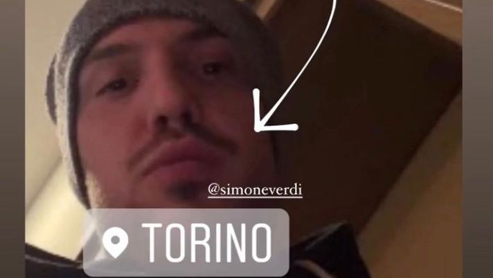 Torino, Verdi negativo: lo rende noto la compagna - immagine 1