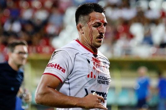 Un giocatore del Petrarca sanguinante durante il match Rugby, test tutt’altro che amichevole tra Rovigo e Petrarca (che finisce a pugni): 62 squalificati- immagine 2