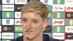 Gordon cade dalla bici: si presenta così