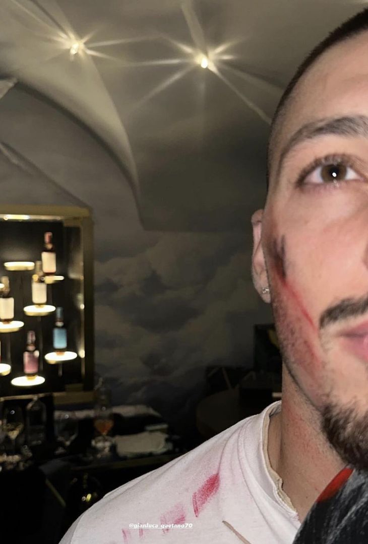 GALLERY È tempo di Halloween in casa Napoli: ecco i costumi dei calciatori azzurri - immagine 11