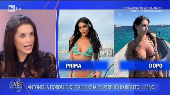 Antonella Fiordelisi: “Chirurgia estetica? Ho rifatto il seno e mi vedo bene: ecco perché” Antonella Fiordelisi: “Chirurgia estetica? Ho rifatto il seno e mi vedo bene: ecco perché” - immagine 1