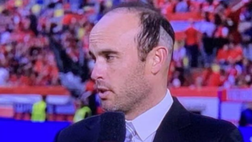 L’acconciatura è virale, Donovan: “Ho fatto il trapianto di capelli, mi hanno detto che…”